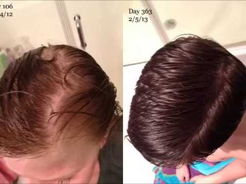 stop hair loss and regrow hair quickly